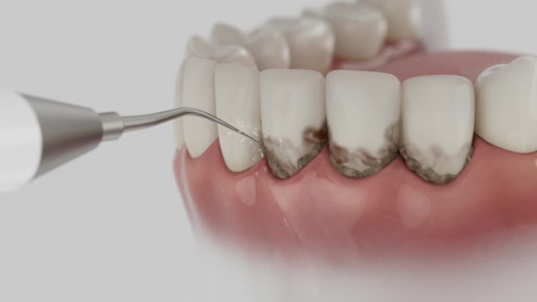 Trusted Root Canal Treatment service in Parma Heights, OH - Dentist Open Now